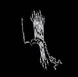 Orthrelm AsristirVeildrioxe album cover